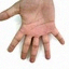 Hand comparison 4, baseline, original sample 0_5_55.png, finger-count error marked in the paper grid
